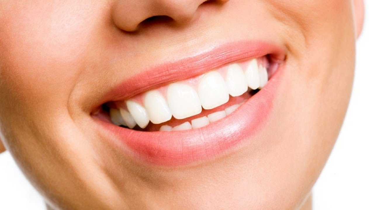 Teeth Cleaning And Whitening In Bristol