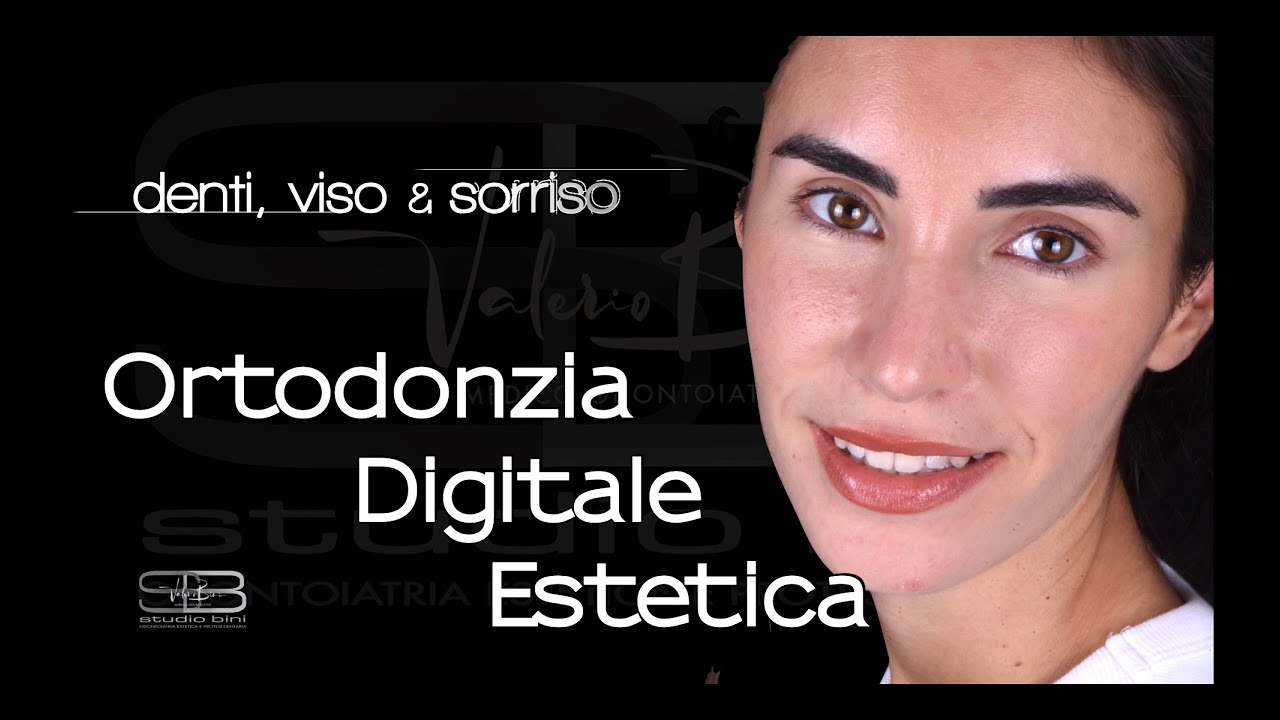 Forever Smiling - Ortodonzia Digitale Estetica