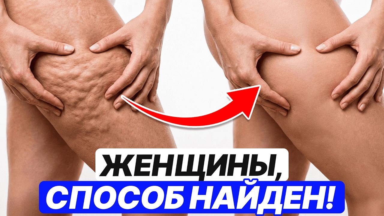 Вы будете жалеть, что не посмотрели раньше! Самый легкий способ убрать целлюлит после 40!