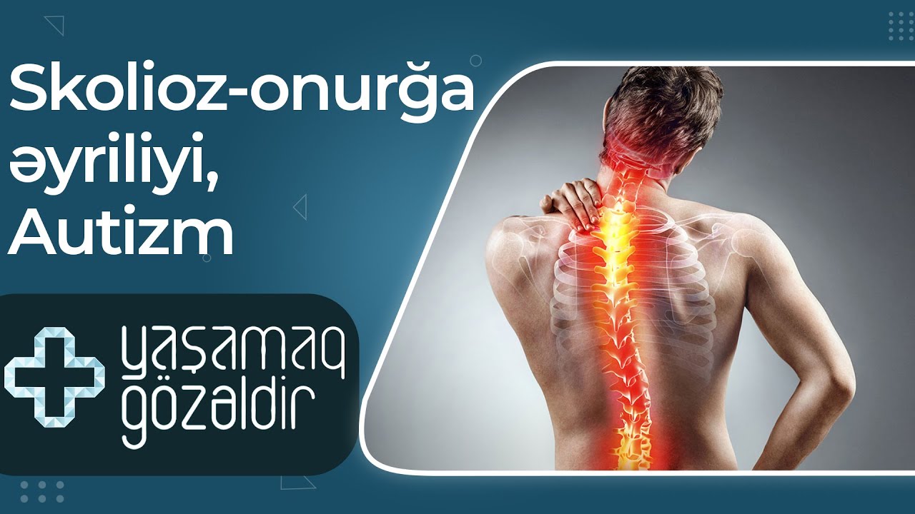 Skolioz – onurğa əyriliyi, Autizm  - Musa Kılıç, Kamran Salayev - 16.02.2022 - Yaşamaq Gözəldir