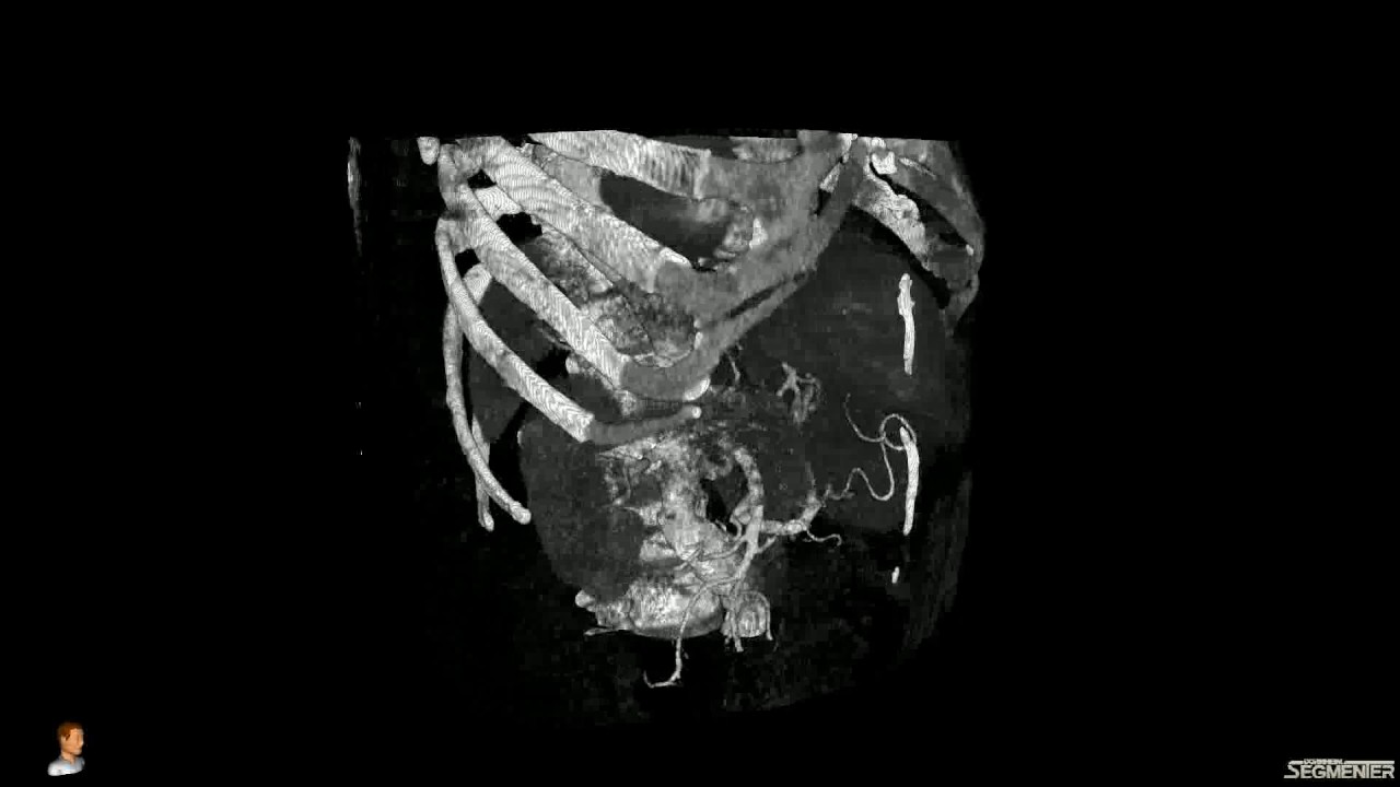 Segmenter DICOM Viewer