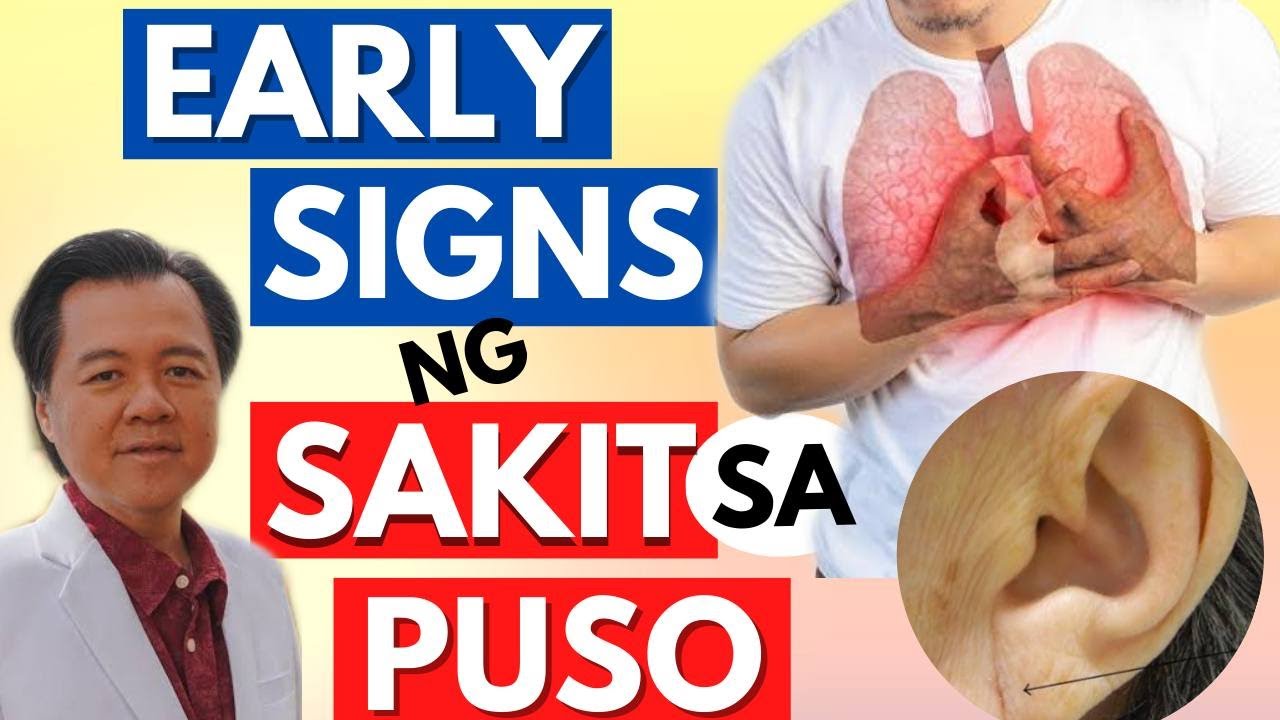 Early Signs ng Sakit sa Puso - By Doc Willie Ong (Internist and Cardiologist)