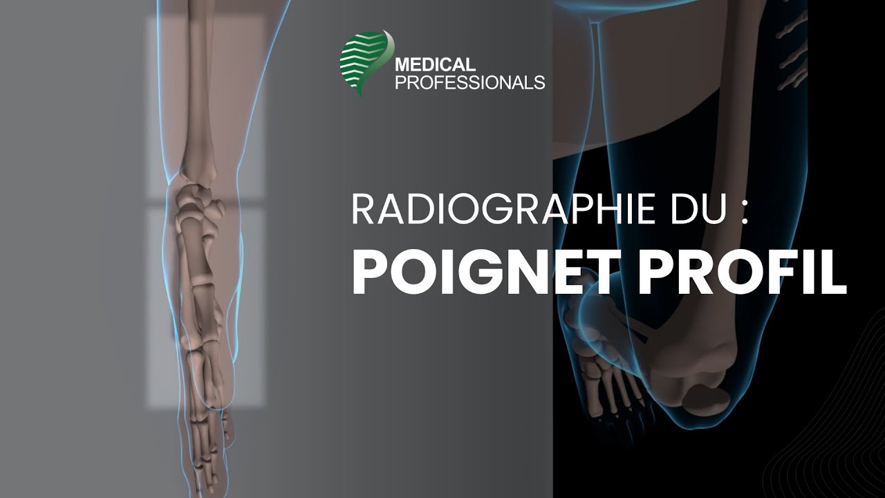 Incidences : Radiographie du POIGNET PROFIL