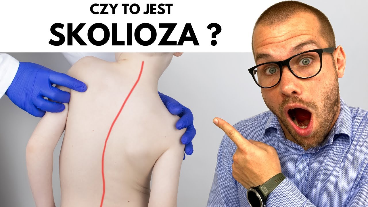 SKOLIOZA - wszystko co musisz wiedzieć !