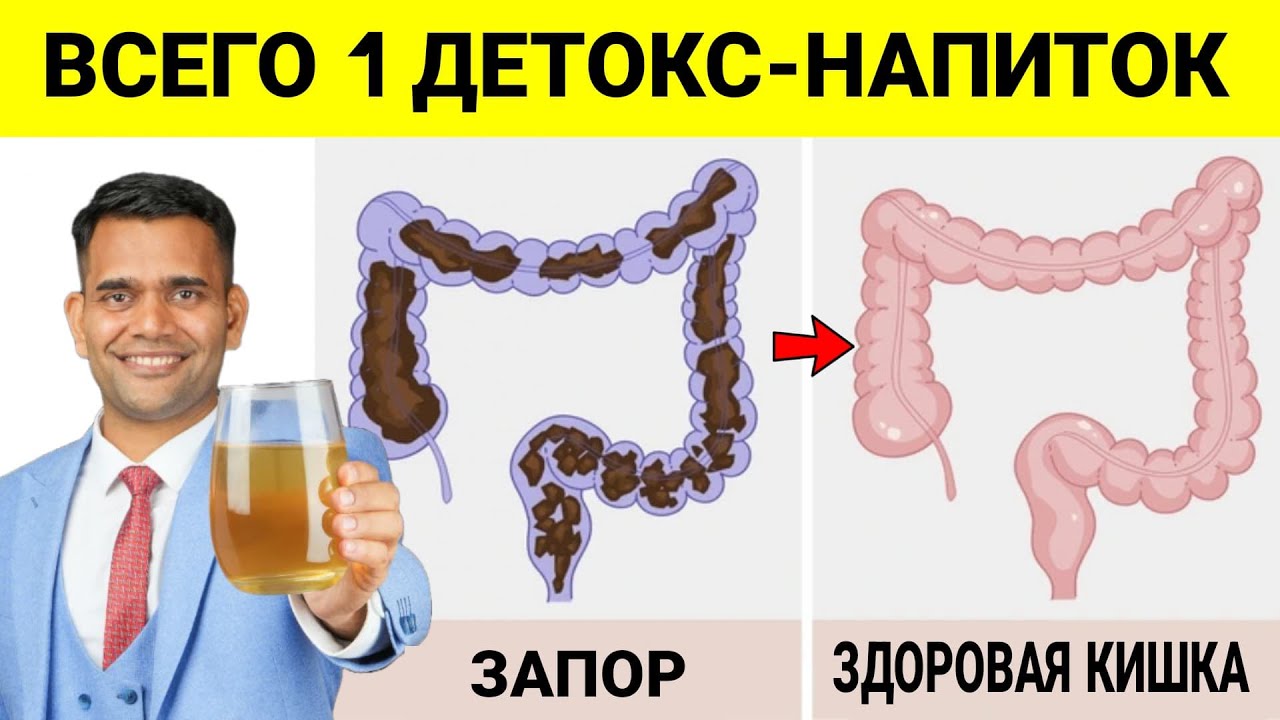 1 МОЩНЫЙ ДЕТОКС НАПИТОК ДЛЯ ОБЛЕГЧЕНИЯ ЗАПОРОВ, УСКОРЕНИЯ ОБМЕНА ВЕЩЕСТВ И ОЧИЩЕНИЯ ОРГАНИЗМА.
