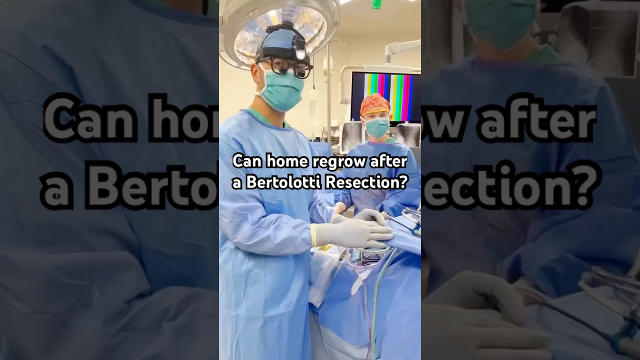 Bertolotti Resection BTS (Part 2)!
