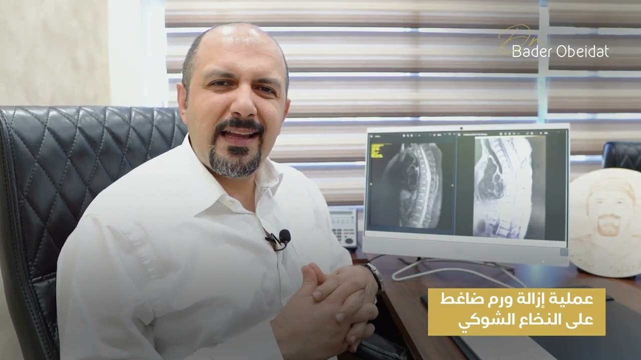 الدكتور بدر عبيدات عملية ورم في الحبل الشوكي
