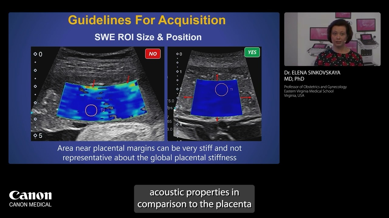 ISUOG 2024 - Доктор Елена Синьковская - Оценка плаценты с использованием новых ультразвуковых инс...