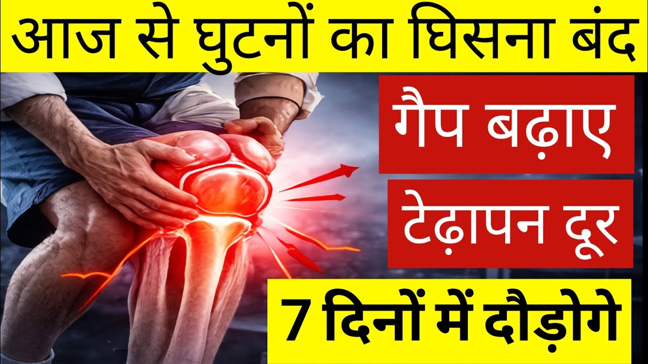 घुटना घिस रहा है? चलना हो गया है मुश्किल?|Knee Gap बढ़ाने की Best Exercise 