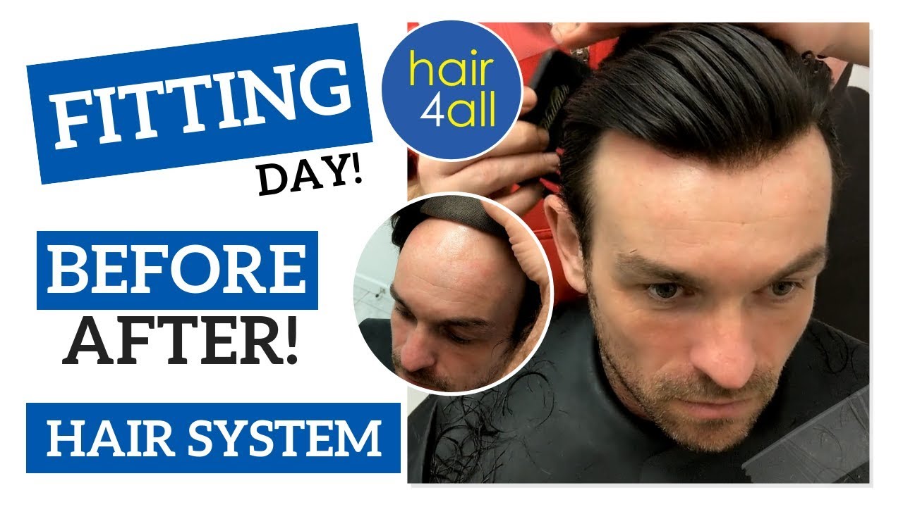 Before & After | Hair System | Non-Surgical Hair Replacement System for Men/Women