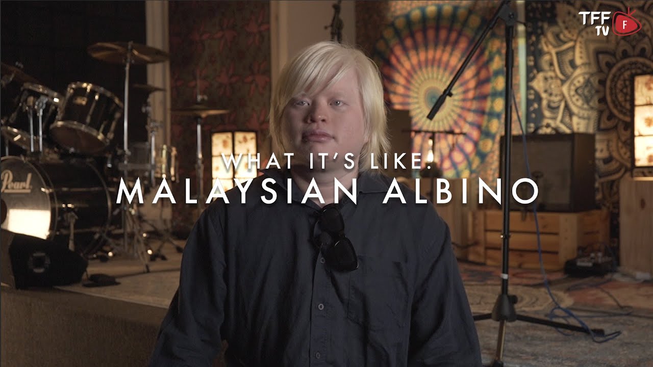 What It's Like: Malaysian Albino