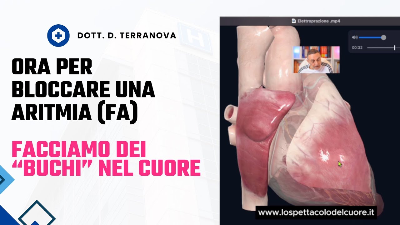 Elettroporazione: il fulmine che zittisce le aritmie