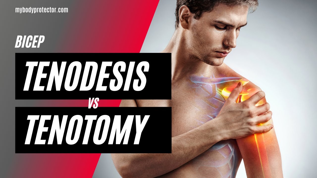 Biceps Tendon Cut or Reattached? What Most Patients Don&rsquo;t Realize
