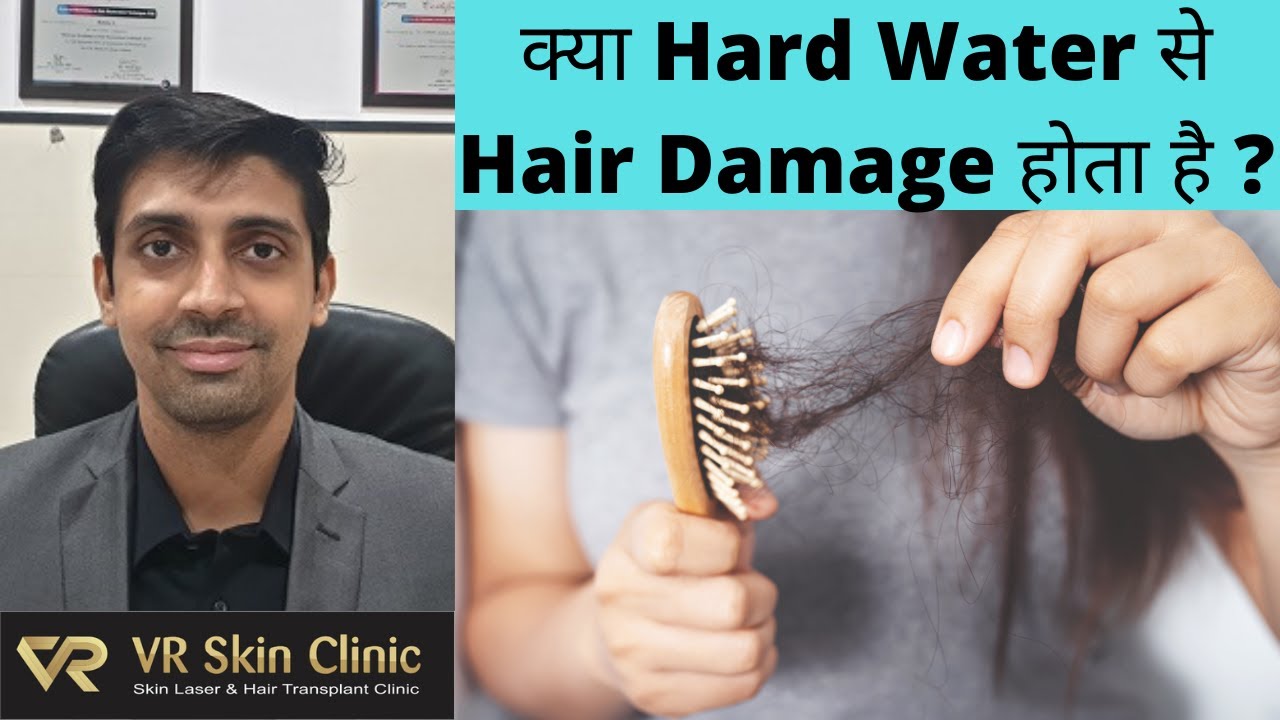 क्या Hard Water से बालों को Damage होता है? पानी change होने से Hair Loss? VR Skin Clinic | Bikaner