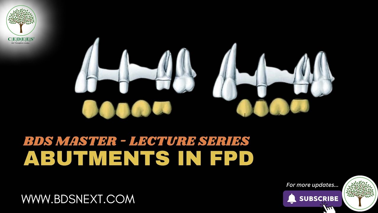 Abutments in FPD - for Final BDS  - Cedees BDS MASTER Lecture Series .