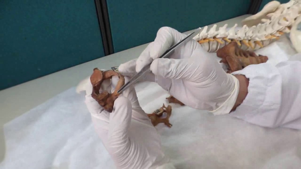 Columna Vertebral