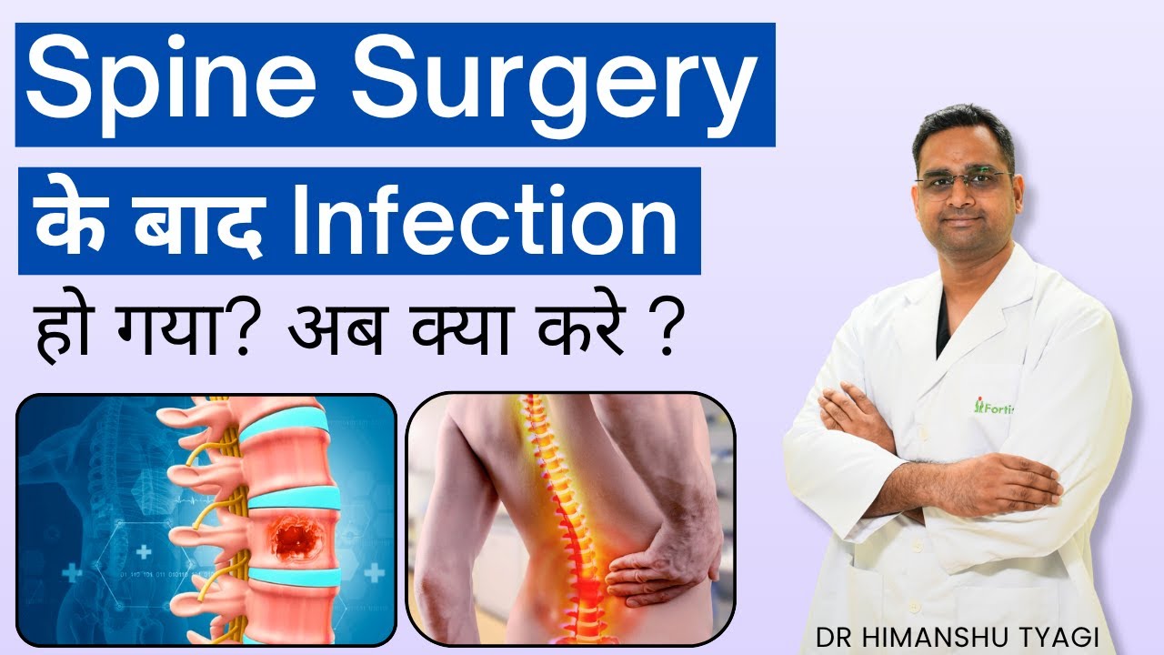 Spine Surgery के बाद Infection हो गया? Infection after spine surgery | Treatment 