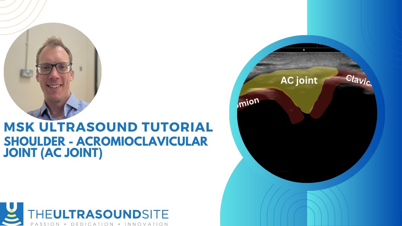 Ультразвуковая оценка акромиально-ключичного сустава