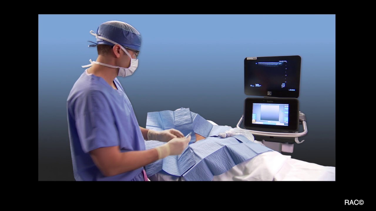 Supraclavicular Brachial Plexus Blockade