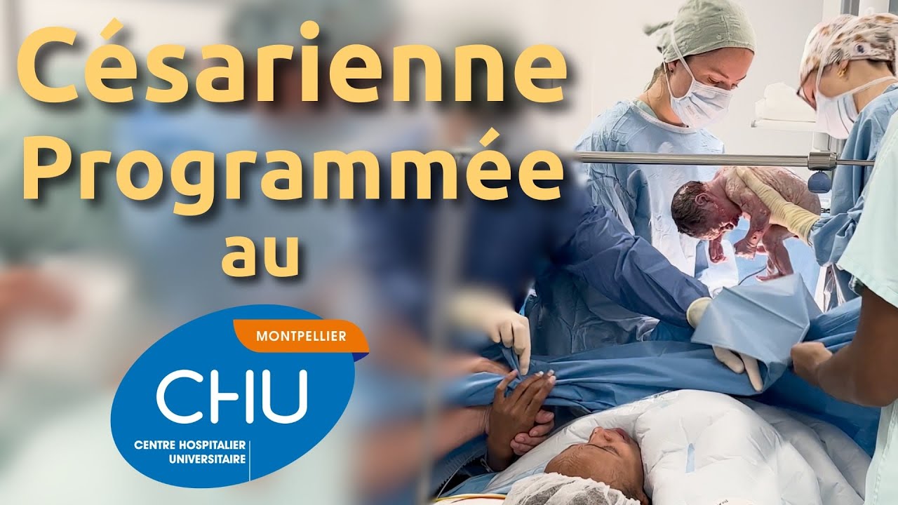 La Césarienne Programmée au CHU de Montpellier.