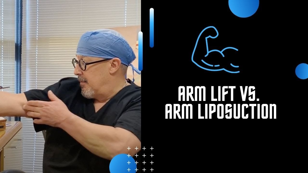Arm Lift vs. Liposuction
