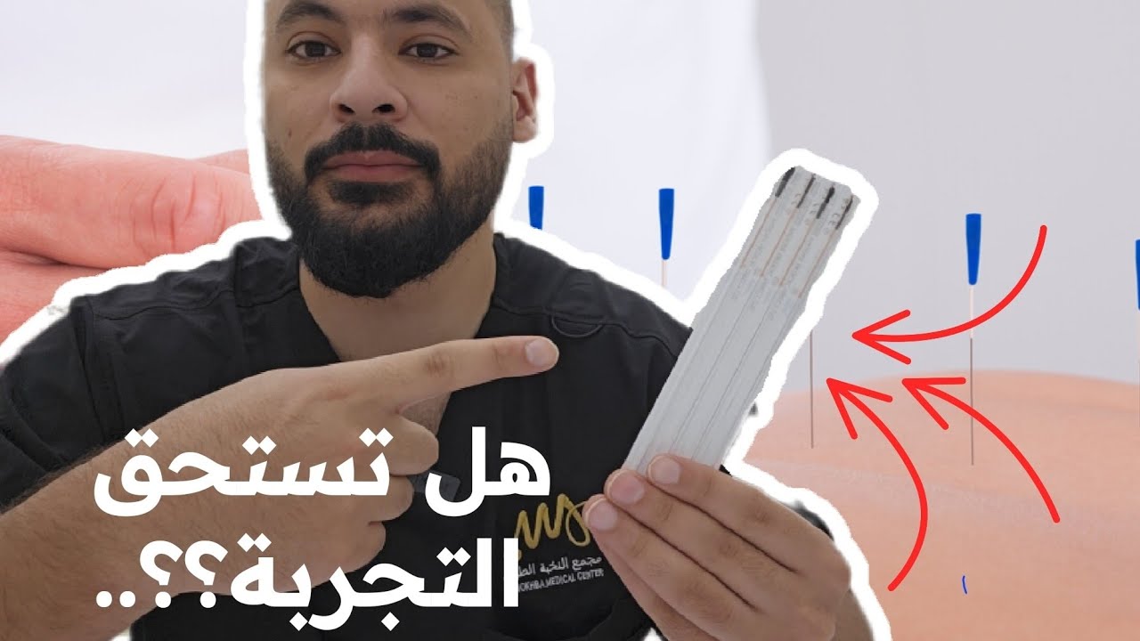 الابر الجافه vs الابر الصينية | اياهم أفضل؟؟