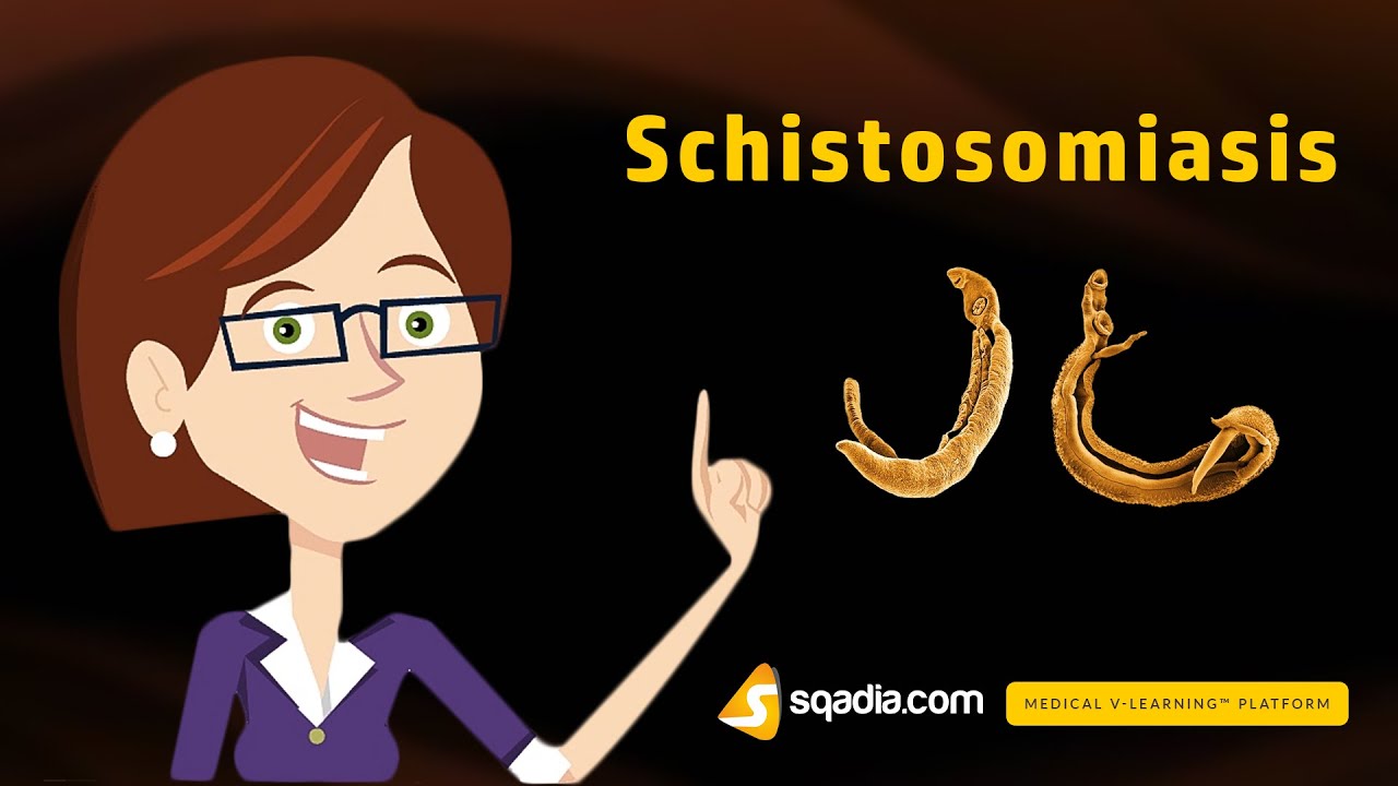 Schistosomiasis |