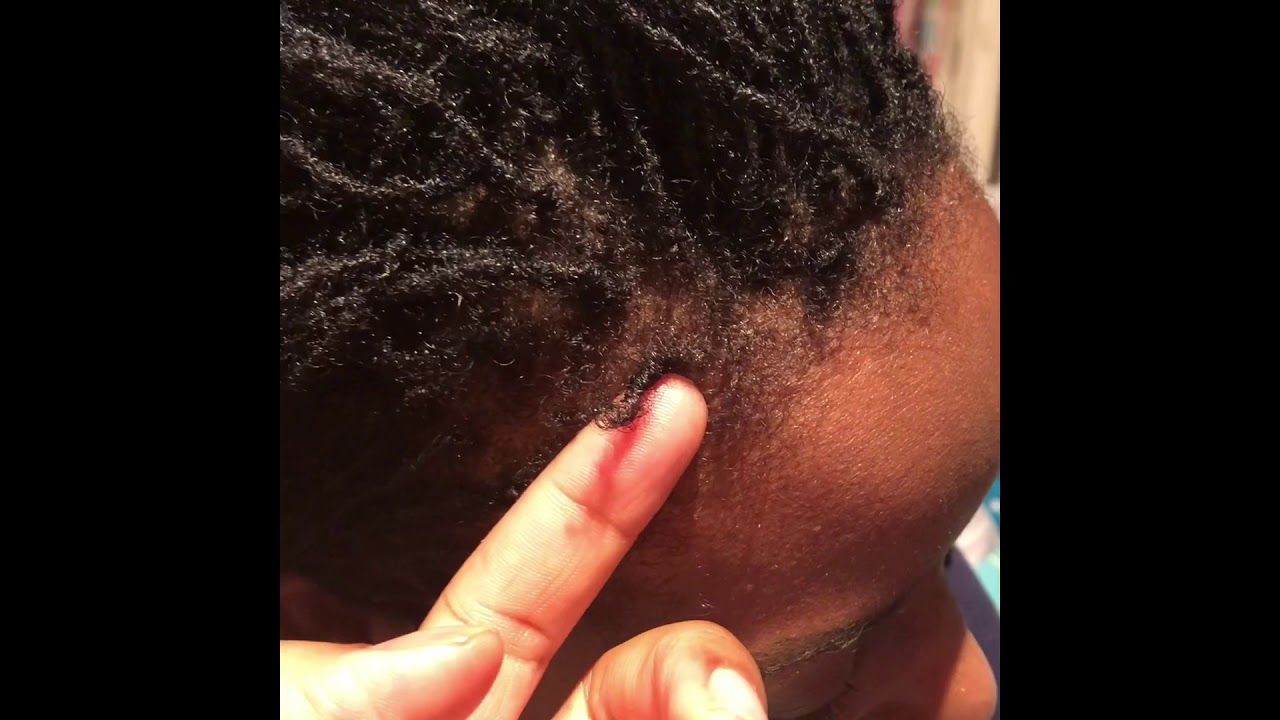 Reattaching my sisterlocks/ sisterlocks/ loc repair