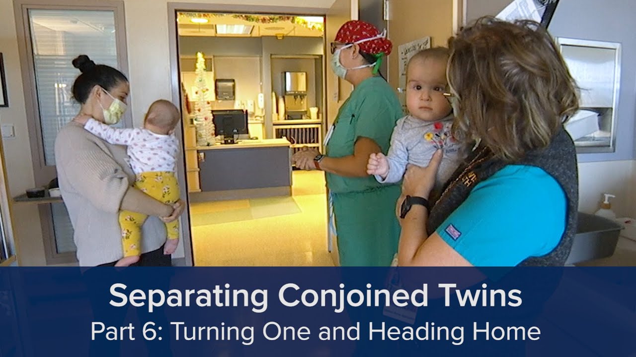 Separating Conjoined Twins Part 6: Turning One and Heading Home