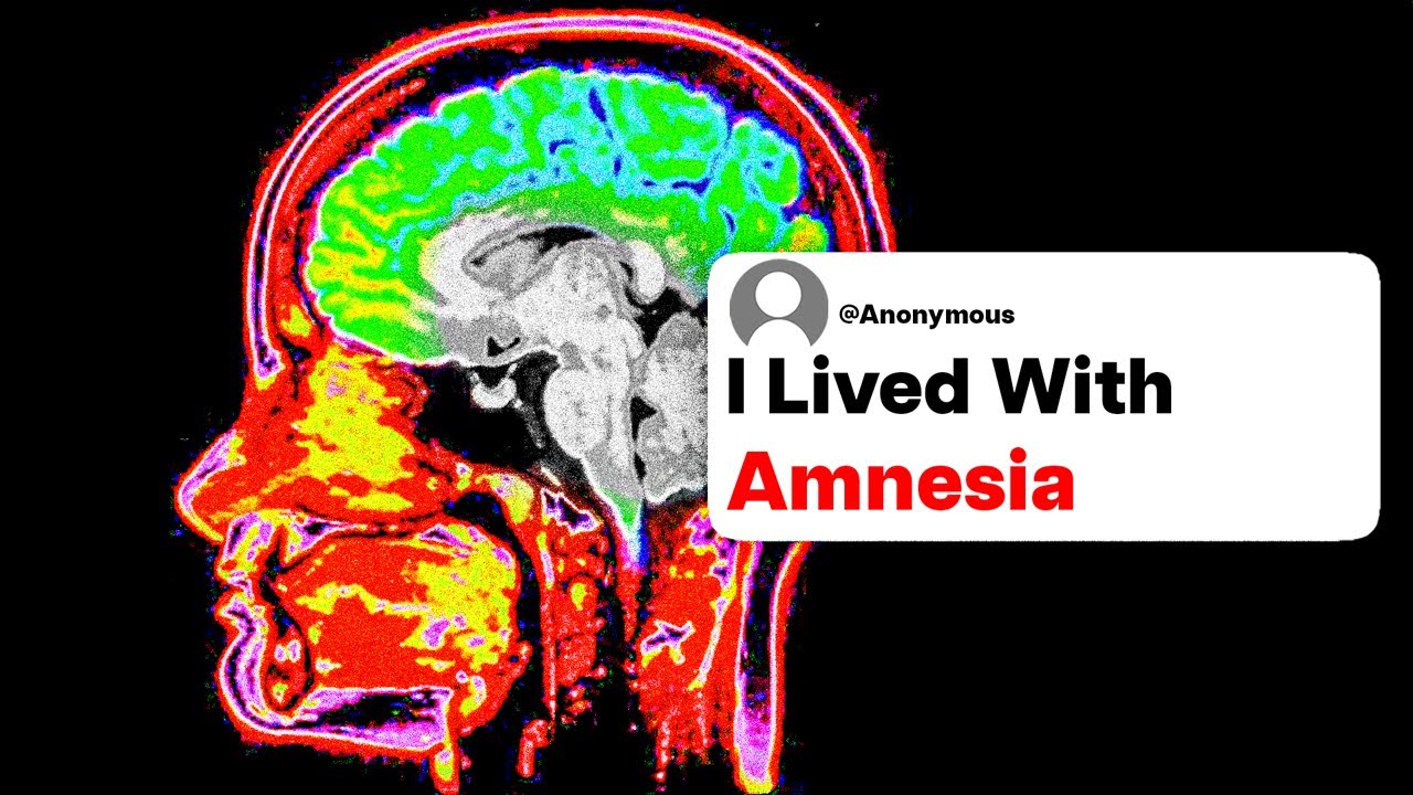 People Who Had Amnesia, What Was It Like Not Knowing Who You Were?