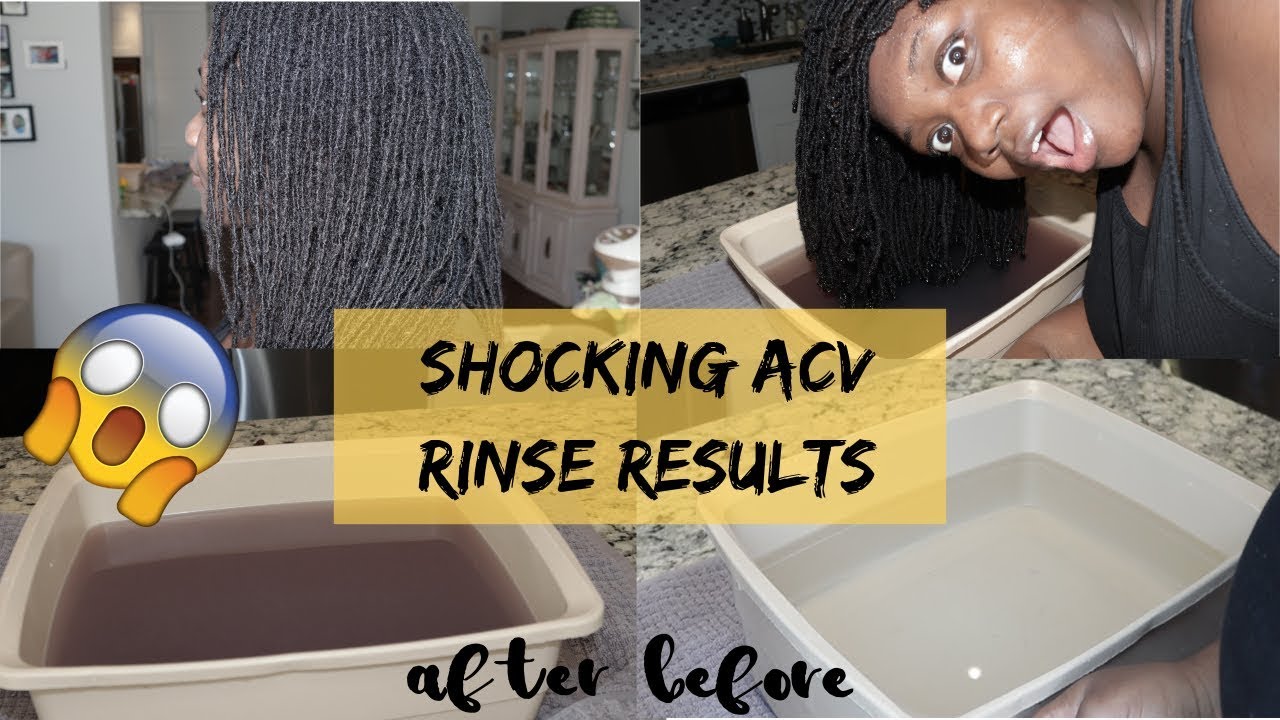 ACV RINSE RESULTS on my LOCS! I WAS SHOCKED
