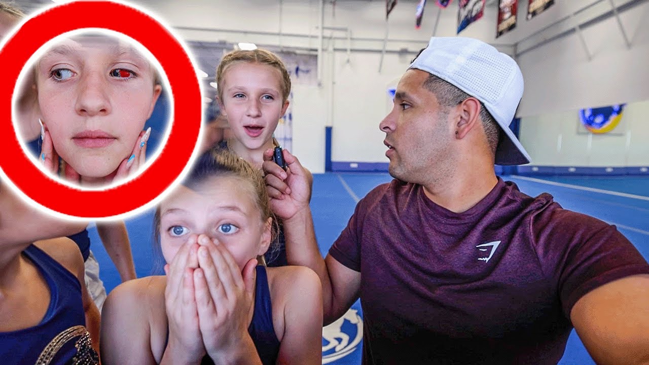 SHE POPPED A BLOOD VESSEL IN HER EYE!