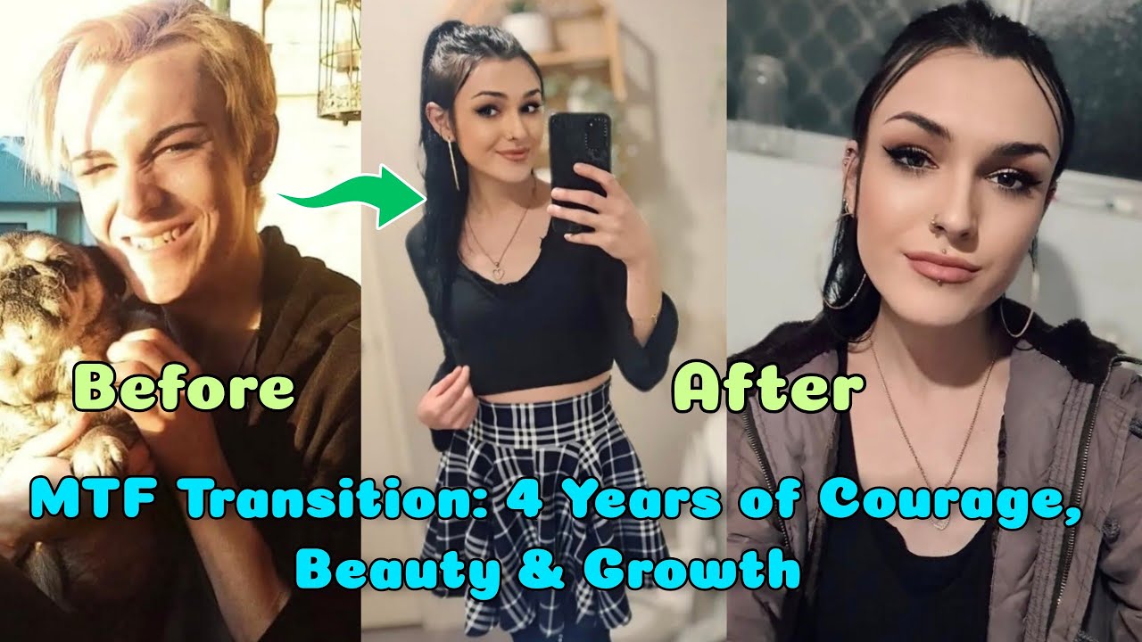 4 Years on HRT: Watch Alice’s Beautiful Transformation | Male to Female Transition | Boy to Girl 