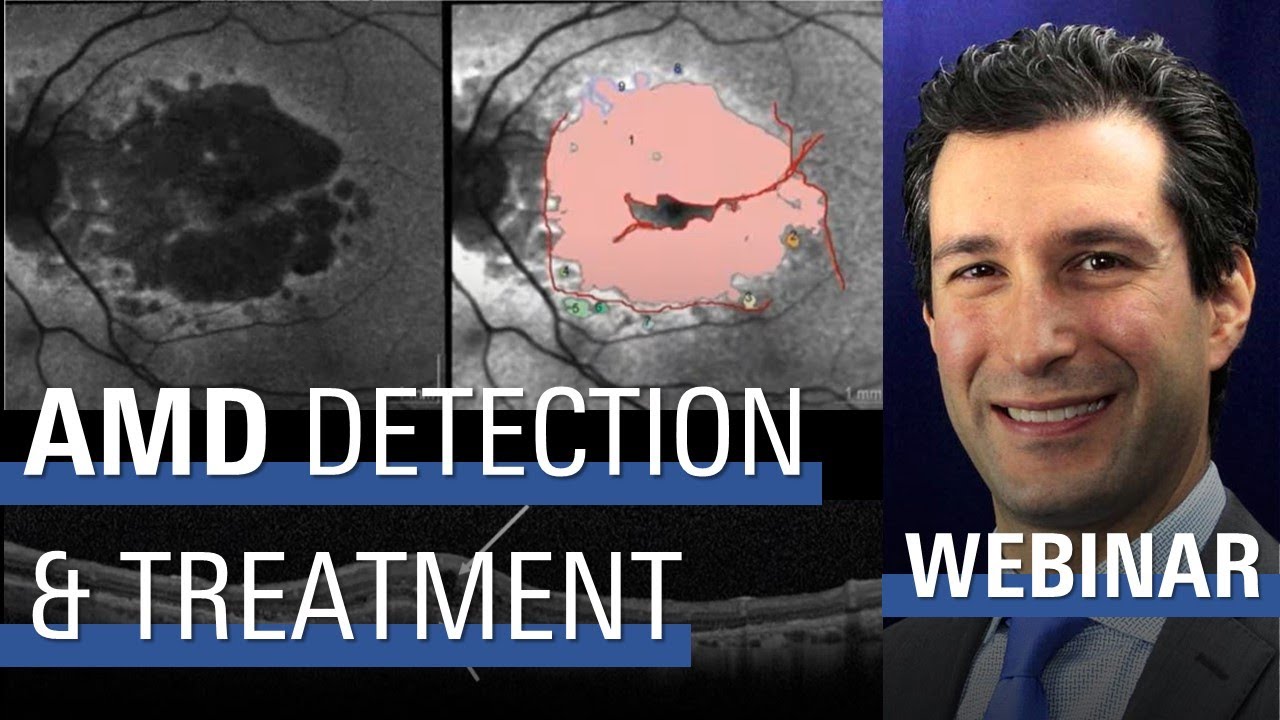 AMD: The State of Detection and Treatment Options