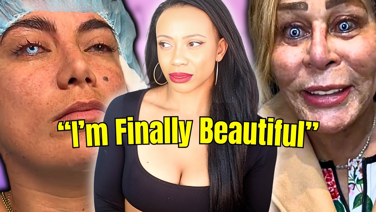 The CREEPY Truth About Eye Color Surgery | Blindness For Beauty, Has Plastic Surgery Gone Too Far?