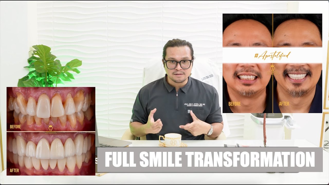 Полное улучшение улыбки | Apostol Dental Philippines