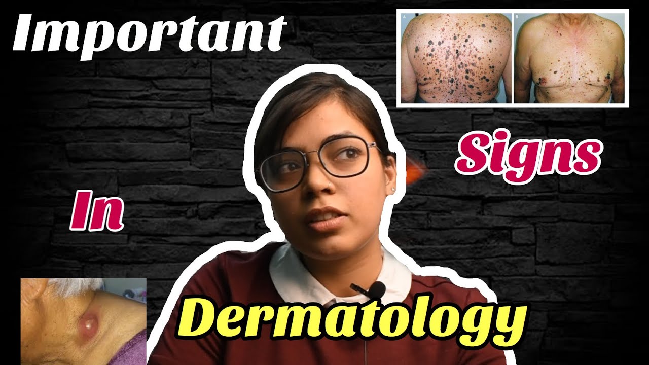 Important Signs in Dermatology