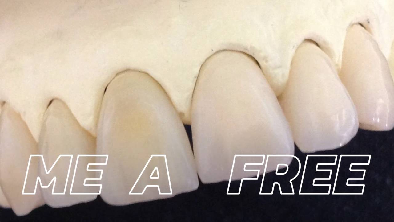 Criart Est&eacute;tica Dental (Pr&oacute;tese  Dental)