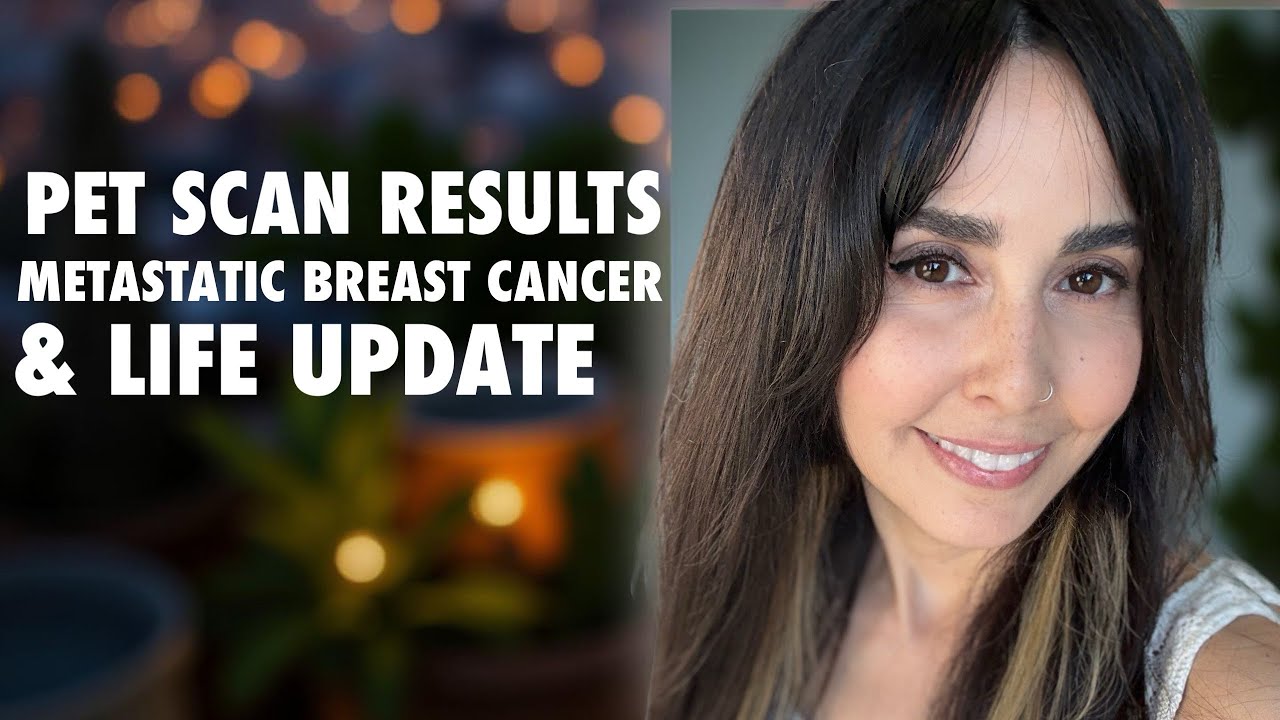 PET SCAN / NEW TREATMENT / LIFE UPDATES 💕