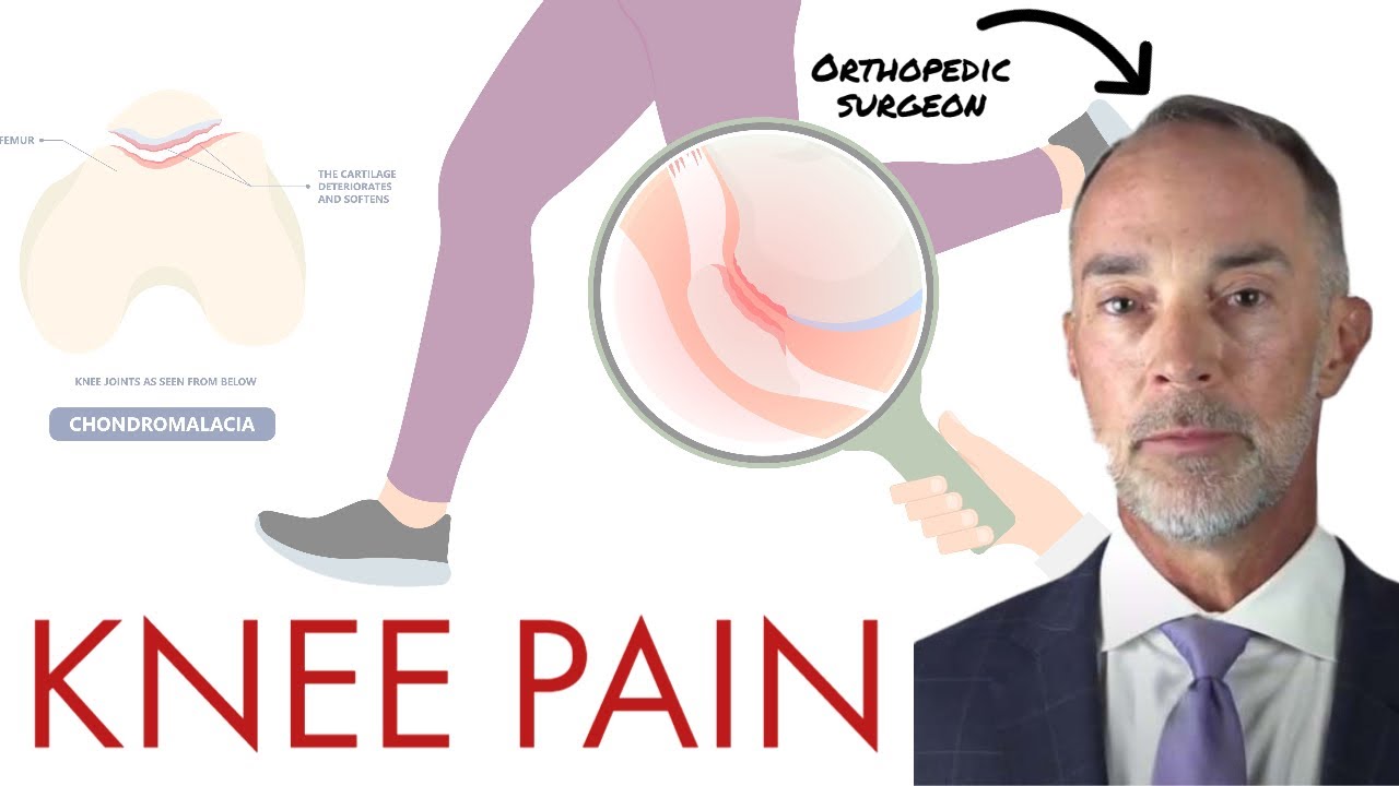 Knee pain due to patellofemoral syndrome, osteoarthritis, chondromalacia: Dr. Eric Eifler, MD