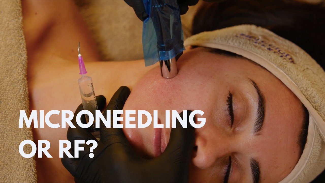Which is better, Microneedling or RF?
