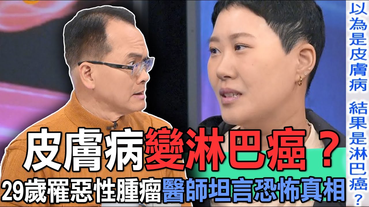 皮膚病變淋巴癌？29歲罹惡性腫瘤醫師坦言恐怖真相【新聞挖挖哇】