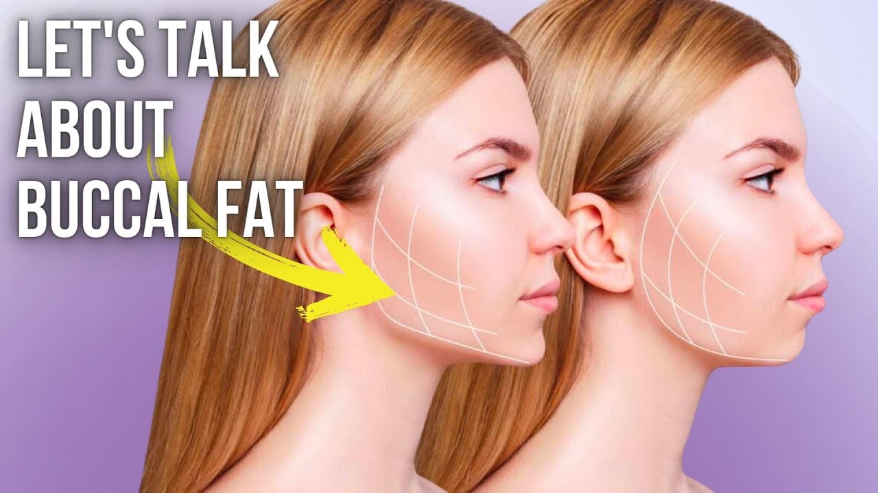 Let's Talk About Buccal Fat | Lesson Of The Day