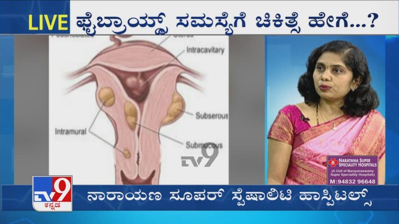 Nimma Doctor | Treatment For Fibroids | Narayana Super Specialty Hospitals