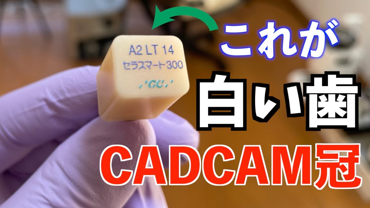 保険でできる白い歯CADCAM冠の作り方