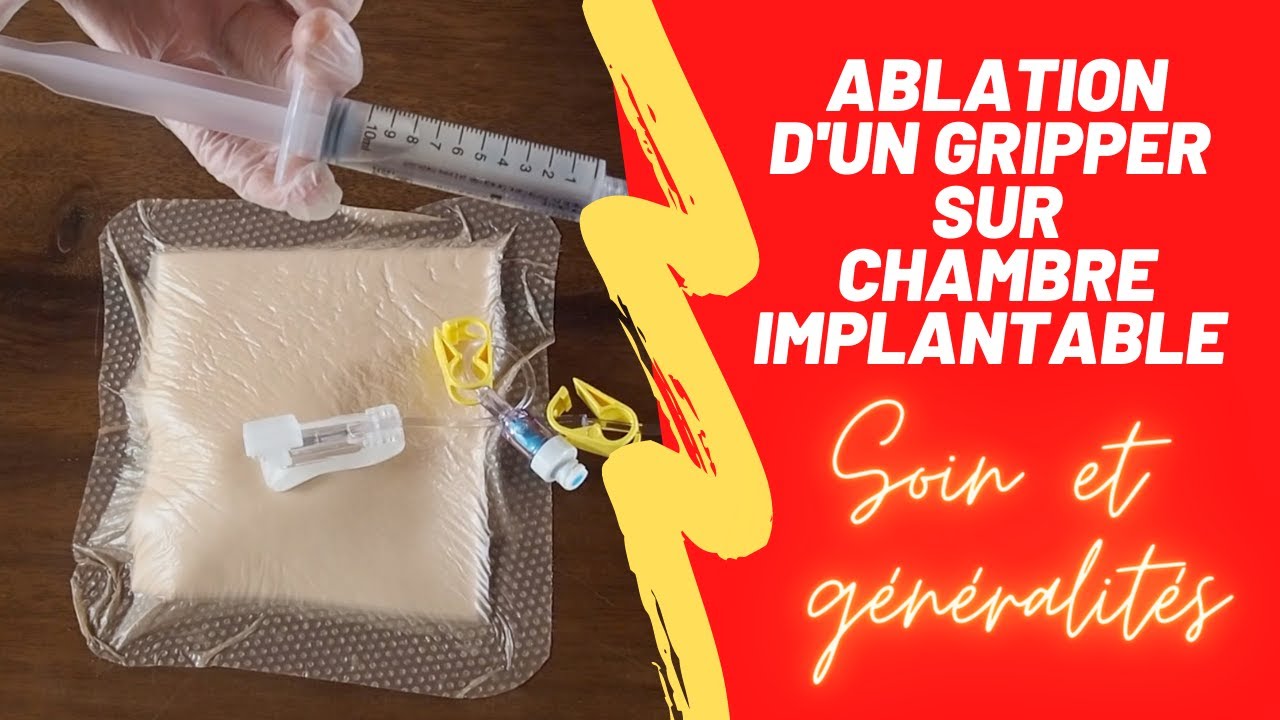 Ablation d'une aiguille de Huber sur CIP
