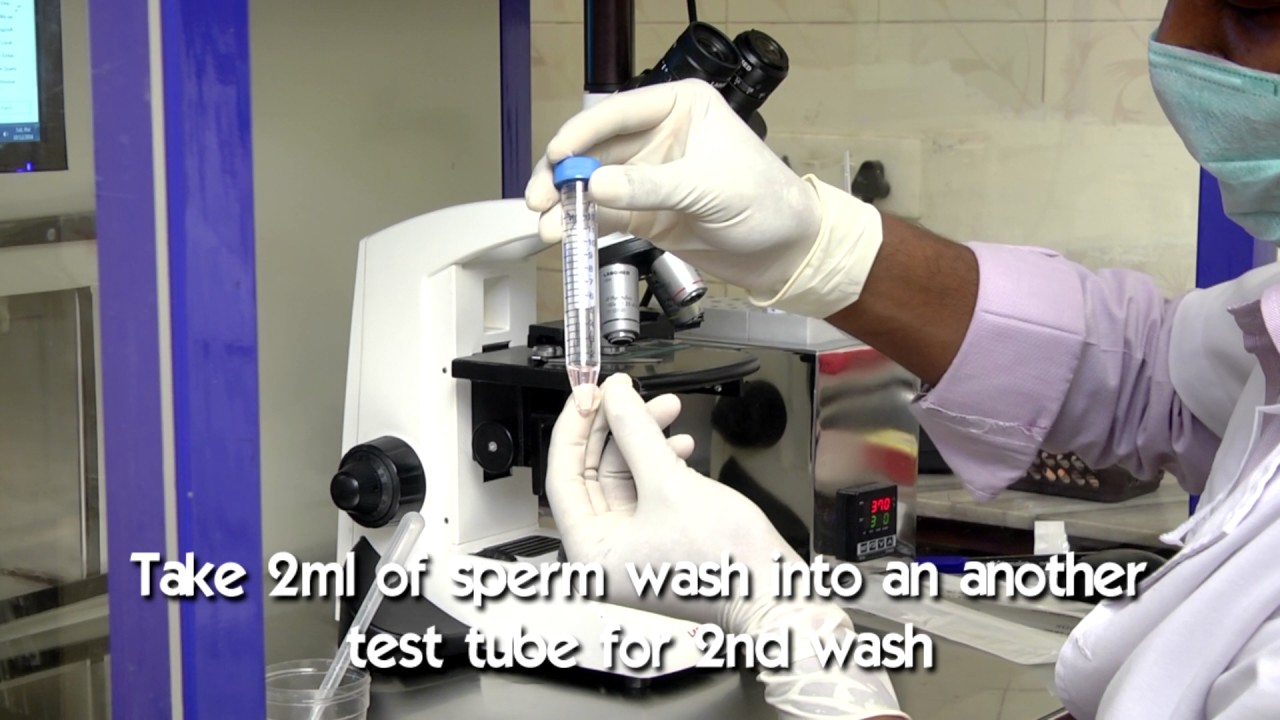Sperm preparation  by Density Gradient Method