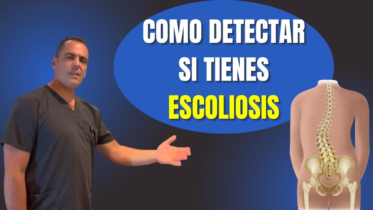 Como puedes DETECTAR si tienes ESCOLIOSIS? #escoliosis #posturaperfecta 