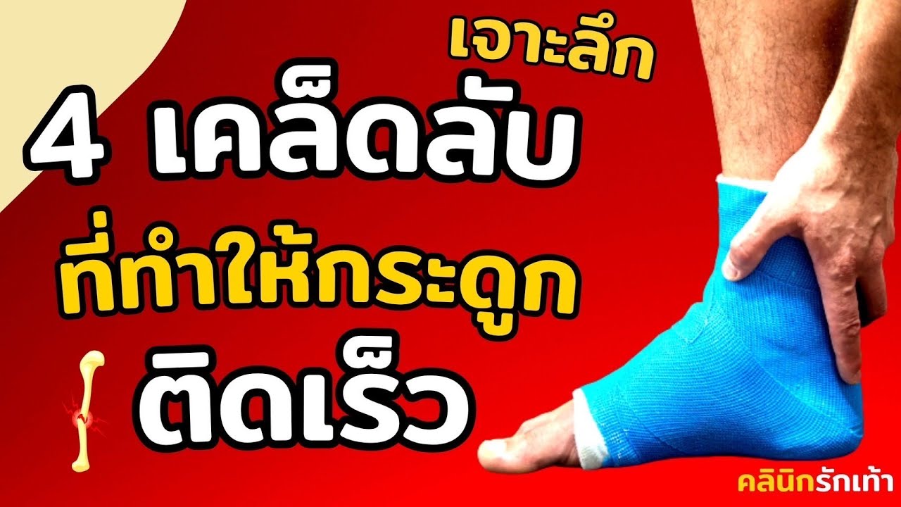 4 เคล็ดลับ ที่จะทำให้กระดูกที่หักติดเร็ว ด้วยหลักทางวิทยาศาสตร์