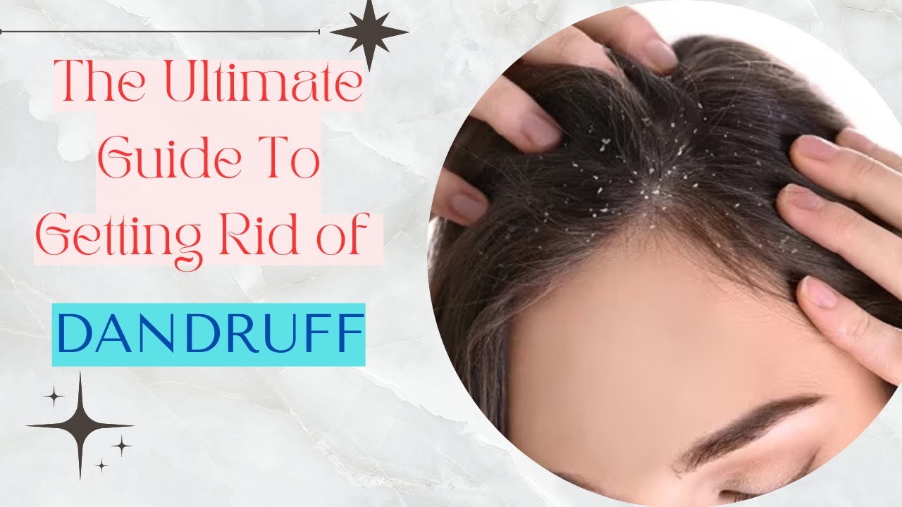 Ultimate Guide to Getting Rid of Dandruff 🤘 #dandruff #wellness #haircare #hairtreatment